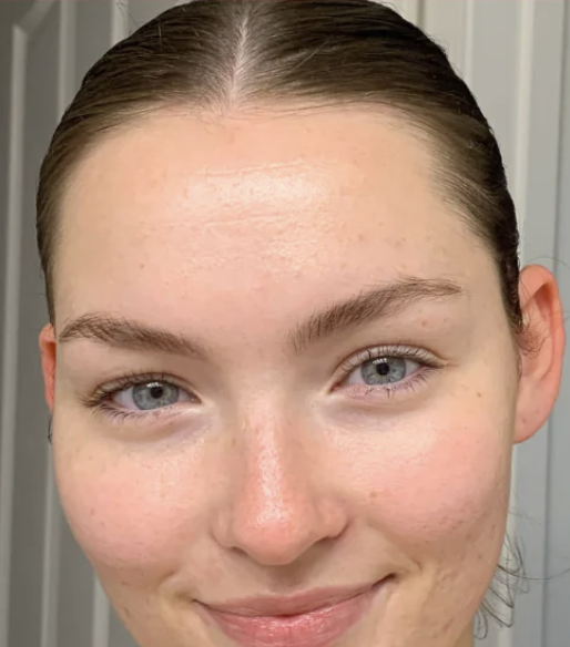 After Facial