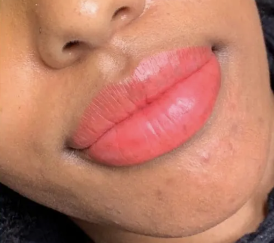 After Lip Blush